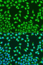 MTCO2 Antibody in Immunocytochemistry (ICC/IF)