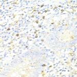 SQSTM1 Antibody in Immunohistochemistry (Paraffin) (IHC (P))