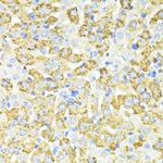 SQSTM1 Antibody in Immunohistochemistry (Paraffin) (IHC (P))