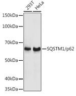 SQSTM1 Antibody in Western Blot (WB)