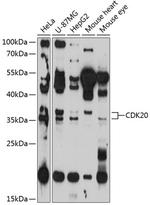 CDK20 Antibody in Western Blot (WB)