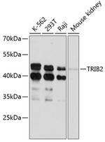 TRIB2 Antibody in Western Blot (WB)