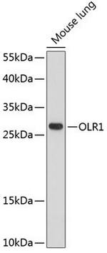 LOX-1 Antibody in Western Blot (WB)