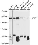 EXOC4 Antibody in Western Blot (WB)