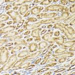 PIK3CA Antibody in Immunohistochemistry (Paraffin) (IHC (P))