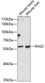 RAG2 Antibody in Western Blot (WB)