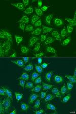 UBE2A Antibody in Immunocytochemistry (ICC/IF)