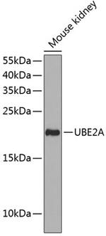 UBE2A Antibody in Western Blot (WB)