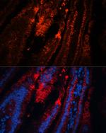 TRPA1 Antibody in Immunohistochemistry (Paraffin) (IHC (P))