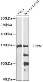 TRPA1 Antibody in Western Blot (WB)