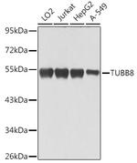 TUBB8 Antibody in Western Blot (WB)