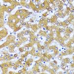 ACOX2 Antibody in Immunohistochemistry (Paraffin) (IHC (P))