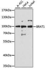BAAT1 Antibody in Western Blot (WB)