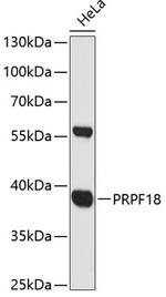 PRPF18 Antibody in Western Blot (WB)