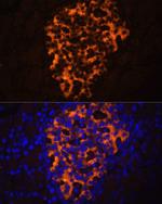 PNLIPRP2 Antibody in Immunohistochemistry (Paraffin) (IHC (P))