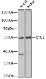 CTU2 Antibody in Western Blot (WB)