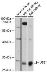 USE1 Antibody in Western Blot (WB)