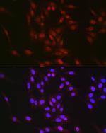 RBM14 Antibody in Immunocytochemistry (ICC/IF)