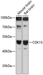 PFTK2 Antibody in Western Blot (WB)