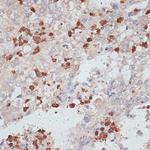 Cathepsin G Antibody in Immunohistochemistry (Paraffin) (IHC (P))