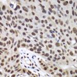 DDX5 Antibody in Immunohistochemistry (Paraffin) (IHC (P))