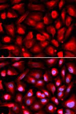 ETS1 Antibody in Immunocytochemistry (ICC/IF)