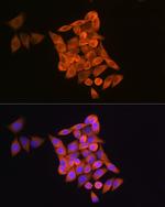 RRM1 Antibody in Immunocytochemistry (ICC/IF)