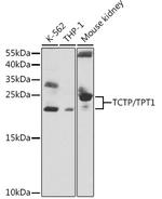 TPT1 Antibody in Western Blot (WB)