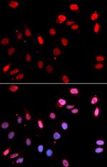 RAD18 Antibody in Immunocytochemistry (ICC/IF)