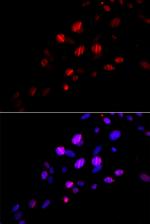 RAD18 Antibody in Immunocytochemistry (ICC/IF)