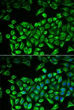 HAS3 Antibody in Immunocytochemistry (ICC/IF)