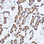 MAOA Antibody in Immunohistochemistry (Paraffin) (IHC (P))