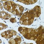 CETP Antibody in Immunohistochemistry (Paraffin) (IHC (P))