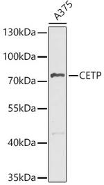 CETP Antibody in Western Blot (WB)