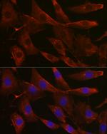UGT1A1 Antibody in Immunocytochemistry (ICC/IF)