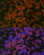 CD38 Antibody in Immunocytochemistry (ICC/IF)