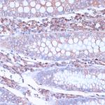 CD38 Antibody in Immunohistochemistry (Paraffin) (IHC (P))