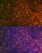 CD38 Antibody in Immunohistochemistry (Paraffin) (IHC (P))