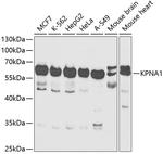 KPNA1 Antibody in Western Blot (WB)