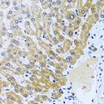 CPA6 Antibody in Immunohistochemistry (Paraffin) (IHC (P))