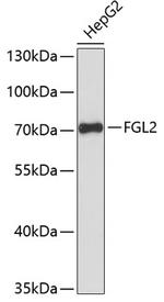 FGL2 Antibody in Western Blot (WB)