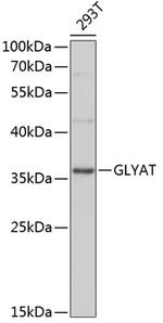 GLYAT Antibody in Western Blot (WB)