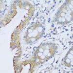 EFCAB4B Antibody in Immunohistochemistry (Paraffin) (IHC (P))