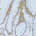 EFCAB4B Antibody in Immunohistochemistry (Paraffin) (IHC (P))