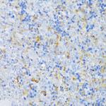 EFCAB4B Antibody in Immunohistochemistry (Paraffin) (IHC (P))