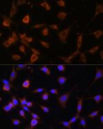 GANAB Antibody in Immunocytochemistry (ICC/IF)