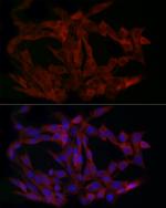 LIMS1 Antibody in Immunocytochemistry (ICC/IF)