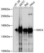 SMC4 Antibody in Western Blot (WB)