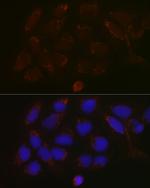 GALNT3 Antibody in Immunocytochemistry (ICC/IF)