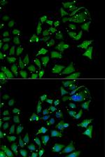 AIPL1 Antibody in Immunocytochemistry (ICC/IF)